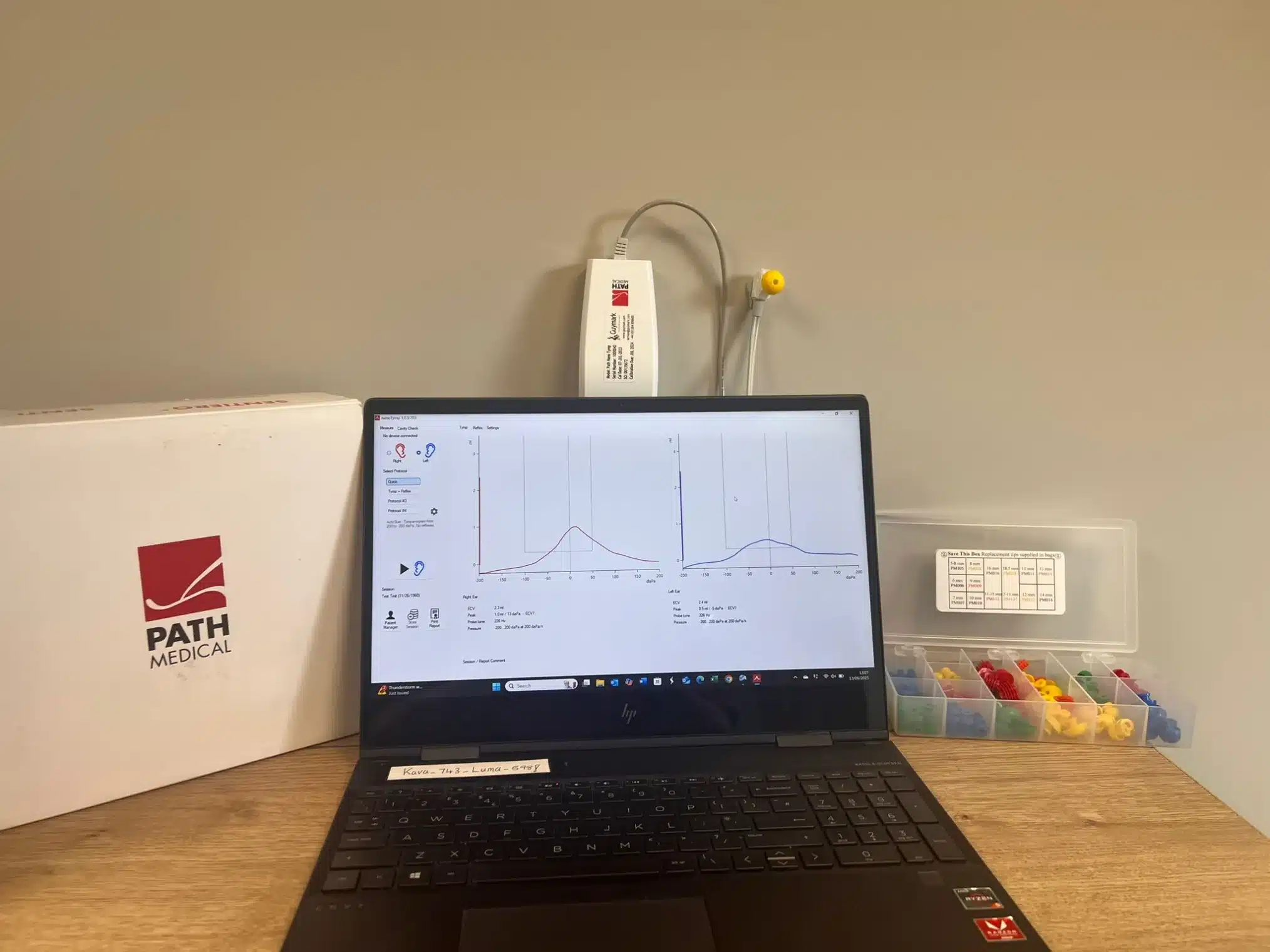 Tympanometry